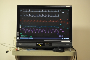 Critical care monitor