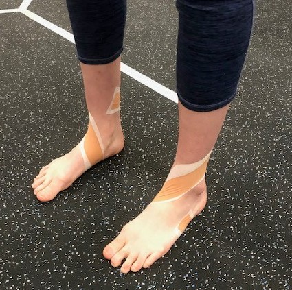 A dancer's feet wrapped in athletic tape.